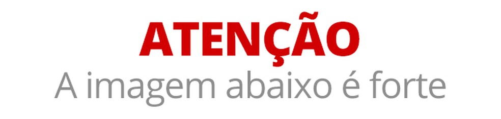 Atenção - a imagem abaixo é forte — Foto: infoesporte