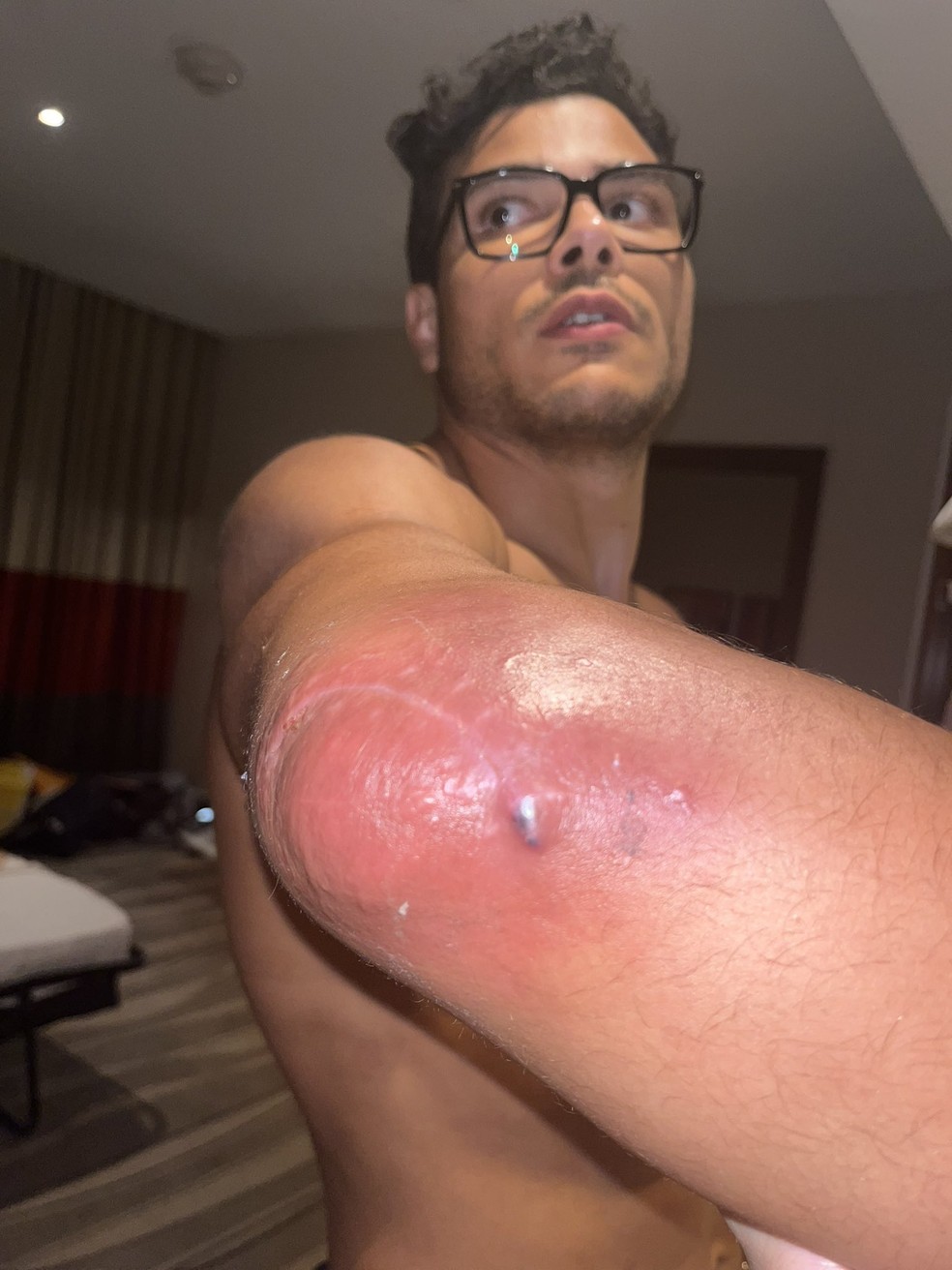 Paulo Borrachinha passou por cirurgia no cotovelo direito — Foto: Reprodução/Twitter