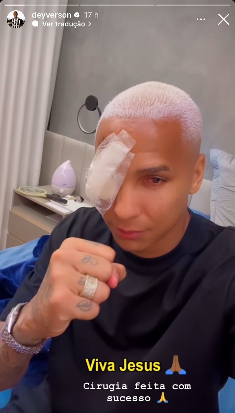 Deyverson passa por cirurgia no olho direito — Foto: Reprodução