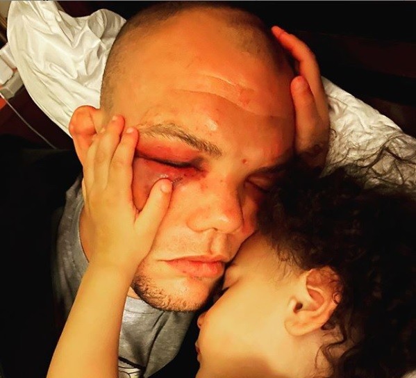 Anthony Smith pede, em post, que não se preocupem com ele: 