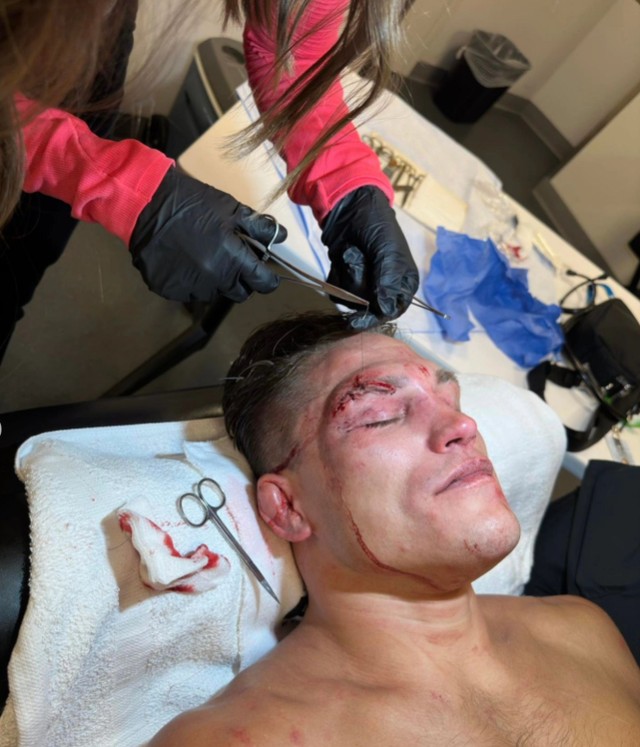 UFC: Drew Dober após a luta contra o brasileiro Jean Silva (Foto: Reprodução/Instagram)