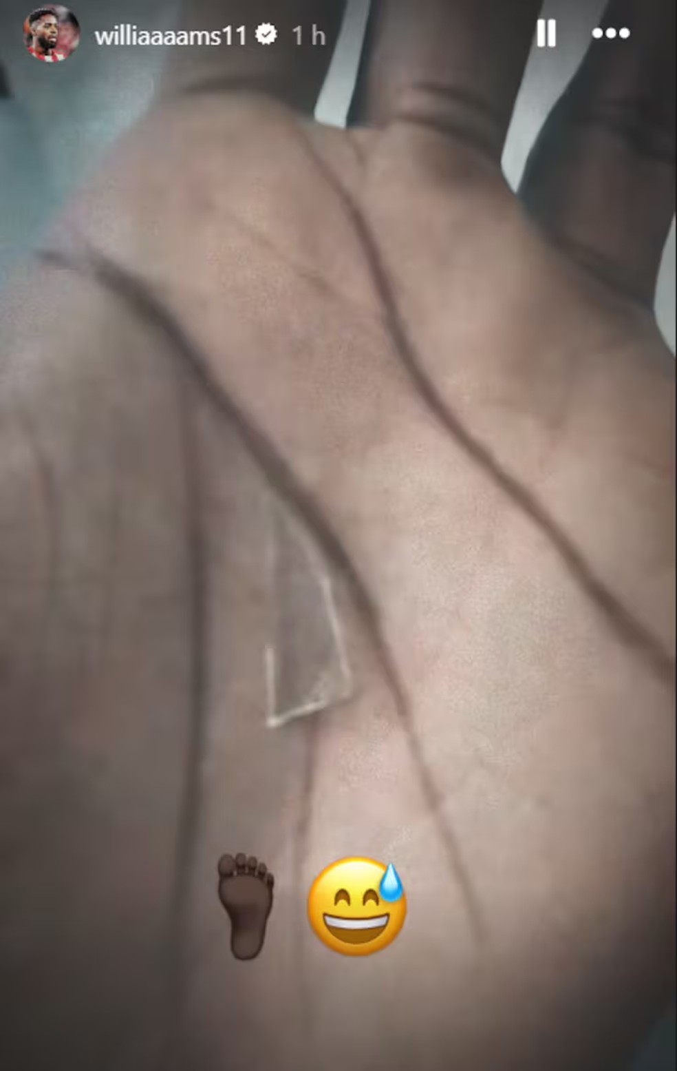 Nas redes sociais, Iñaki Williams mostra o pedaço de vidro que estava em seu pé  — Foto: instagram