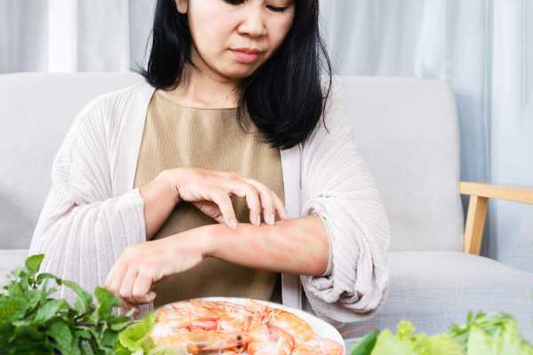 What are food allergies, intolerances and sensitivities | Nutrition