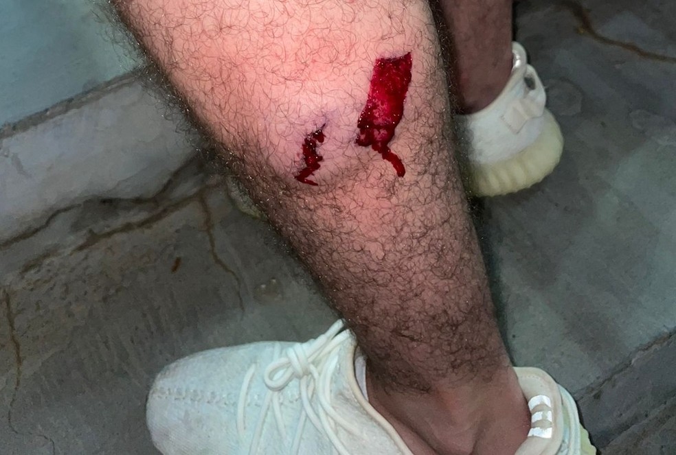 Torcedor; ferimento; São Paulo; Uberaba — Foto: Reprodução/Redes Sociais