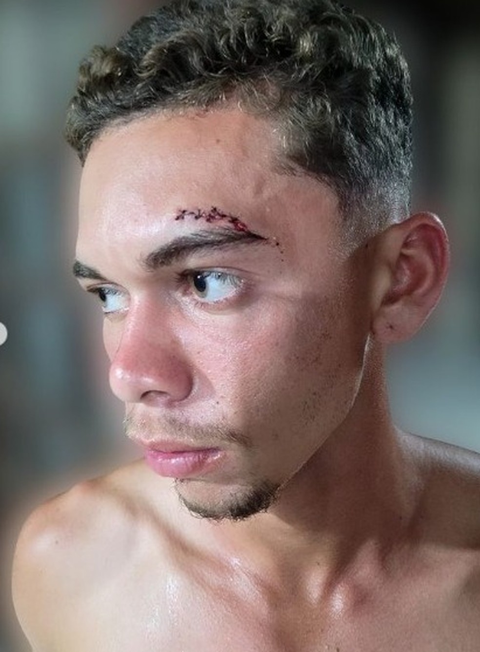 O lateral Ryan precisou levar pontos  — Foto: ASCOM Aliança