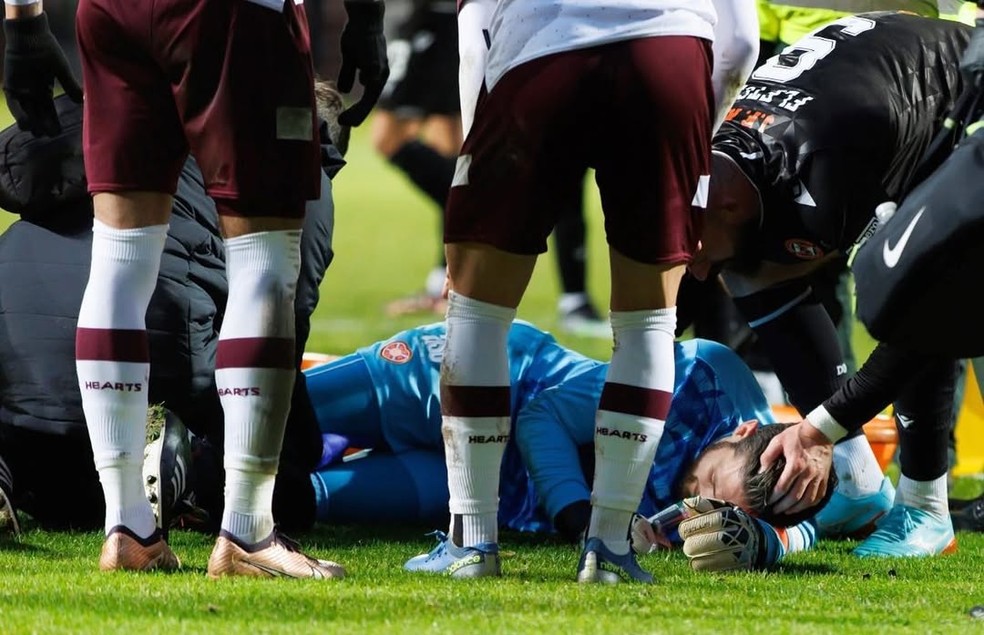 Histórico de lesões de Craig Gordon