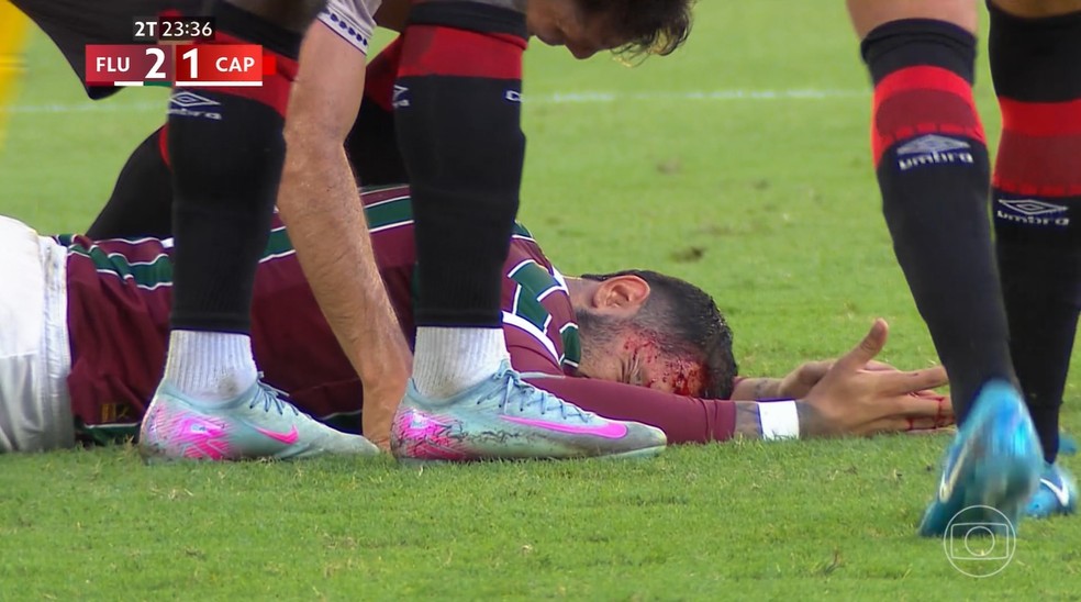 Drama e superação: Freytes sofre corte na cabeça, mas Fluminense vence o Athletico-PR