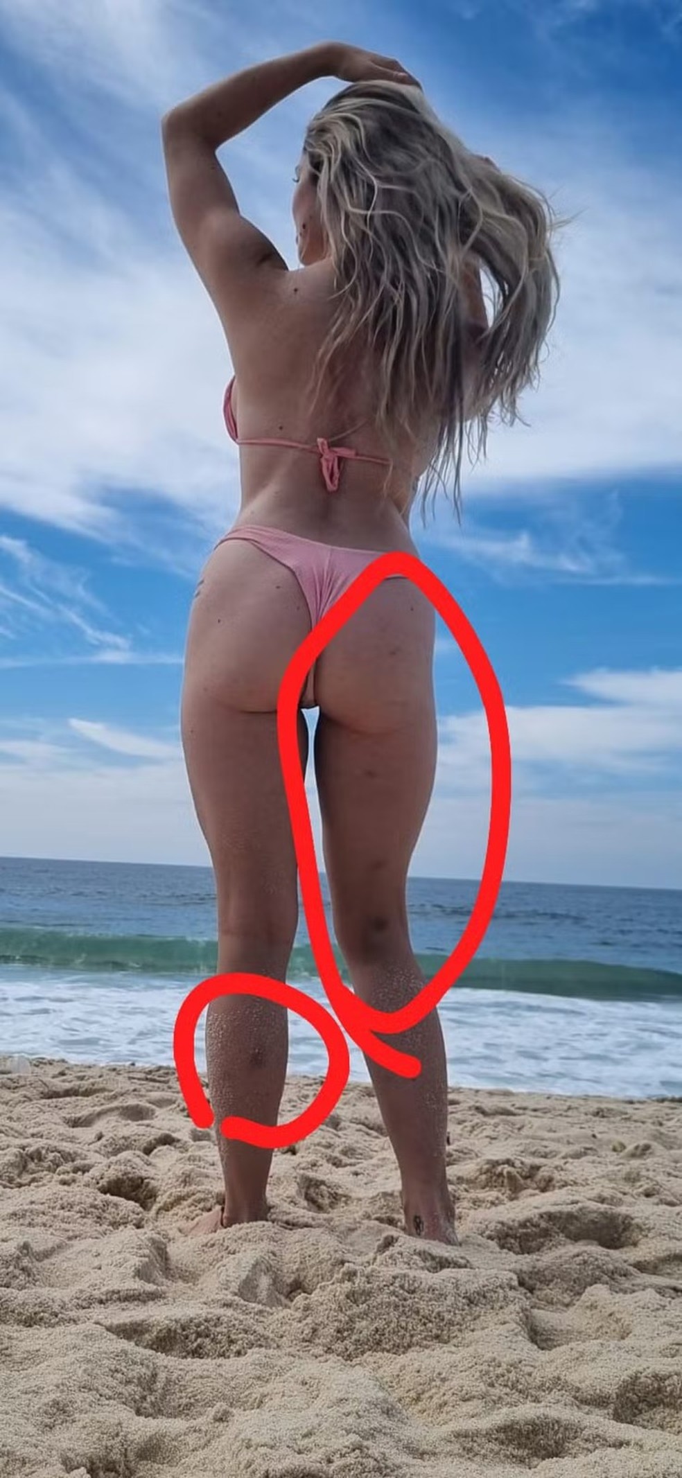 Larissa Natalya Ferrari mostra hematomas após suposta agressão — Foto: Reprodução