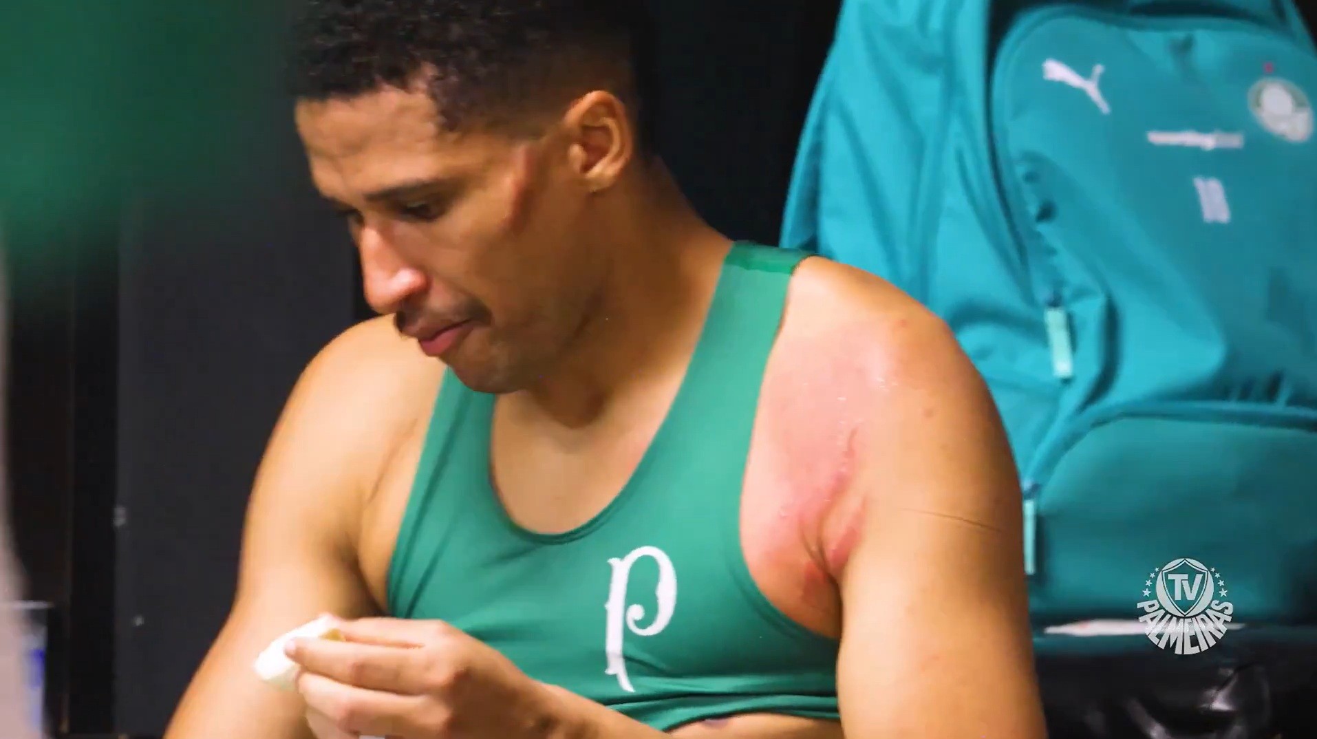 Em vídeo, Palmeiras mostra cicatrizes em Murilo causadas por entrada de Carrascal, do Flamengo