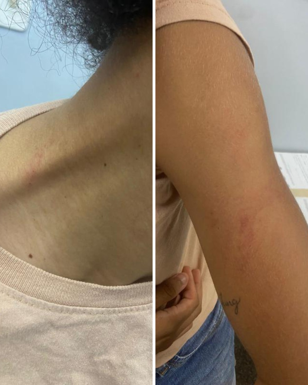 Joice acusou o ex-namorado, árbitro amazonense, de agressão — Foto: Reprodução