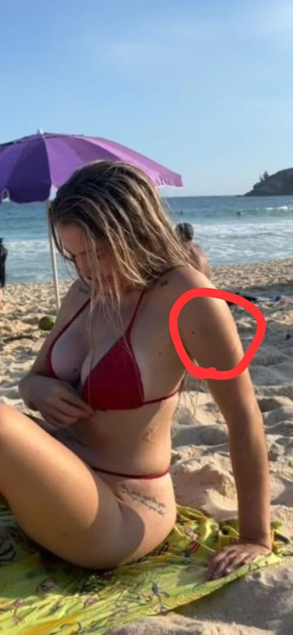 Larissa Natalya Ferrari mostra hematomas após suposta agressão — Foto: Reprodução