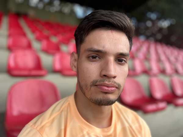 Cicatriz na testa de Bobadilla: lembrança de ter jogado no São Paulo