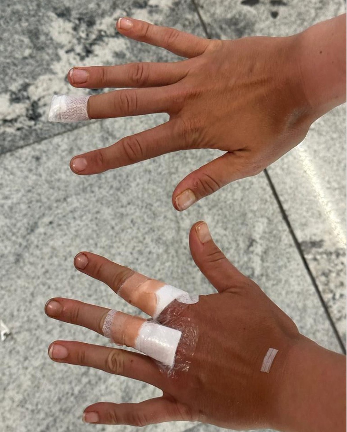 Bia Haddad se lesionó las manos en un accidente en un hotel de México |  tenis