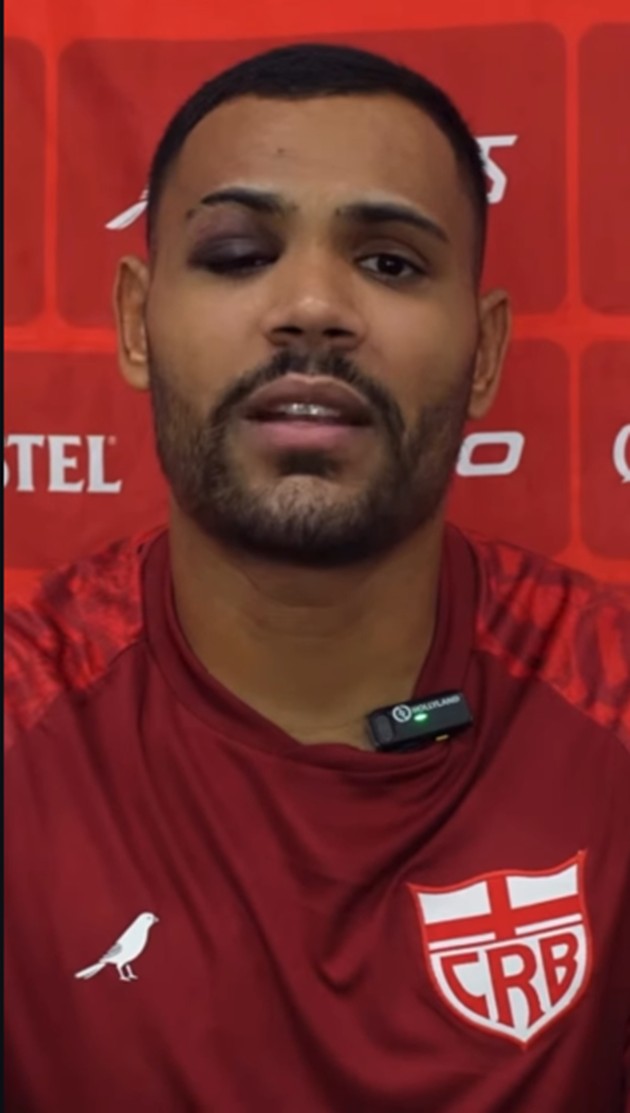 O que houve, artilheiro? Ex-Sport, Mikael vai para coletiva do CRB com um olho roxo