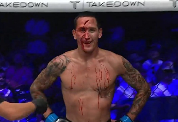 Justin Gonzales sorri com o corte enorme na testa durante luta na PFL &mdash; Foto: Reprodu&ccedil;&atilde;o