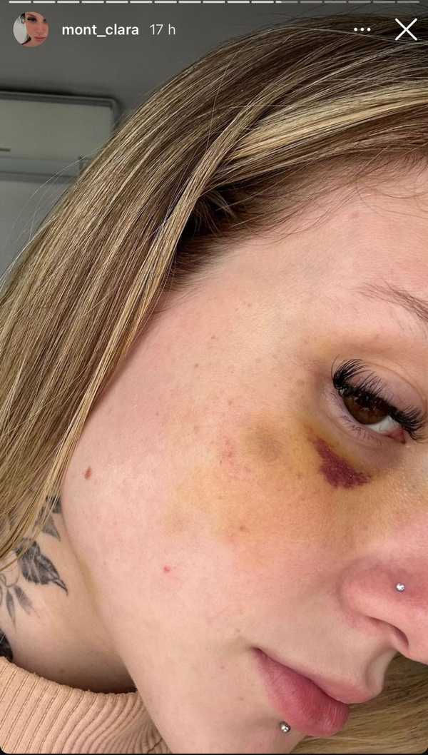 Polícia investiga denúncia de agressão contra ex-mulher de jogador Caio Paulista