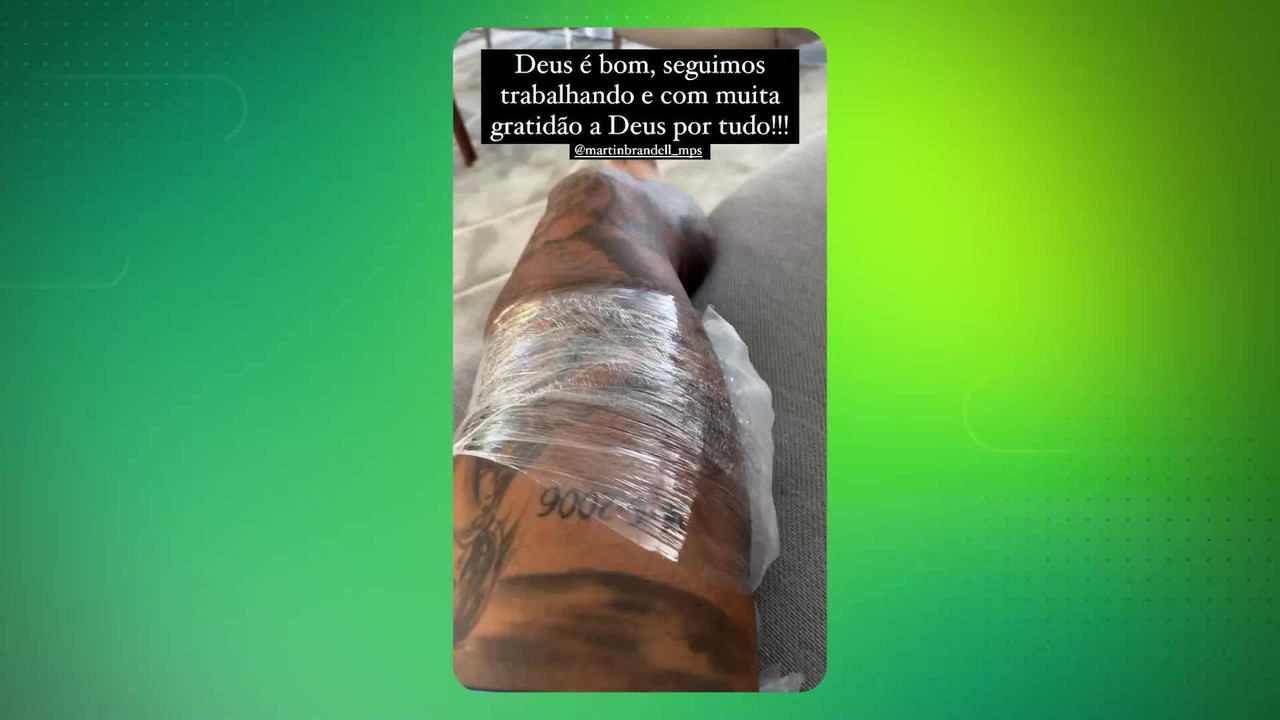 Felipe Melo posta vídeo sobre lesão: 'Não foi nada grave'