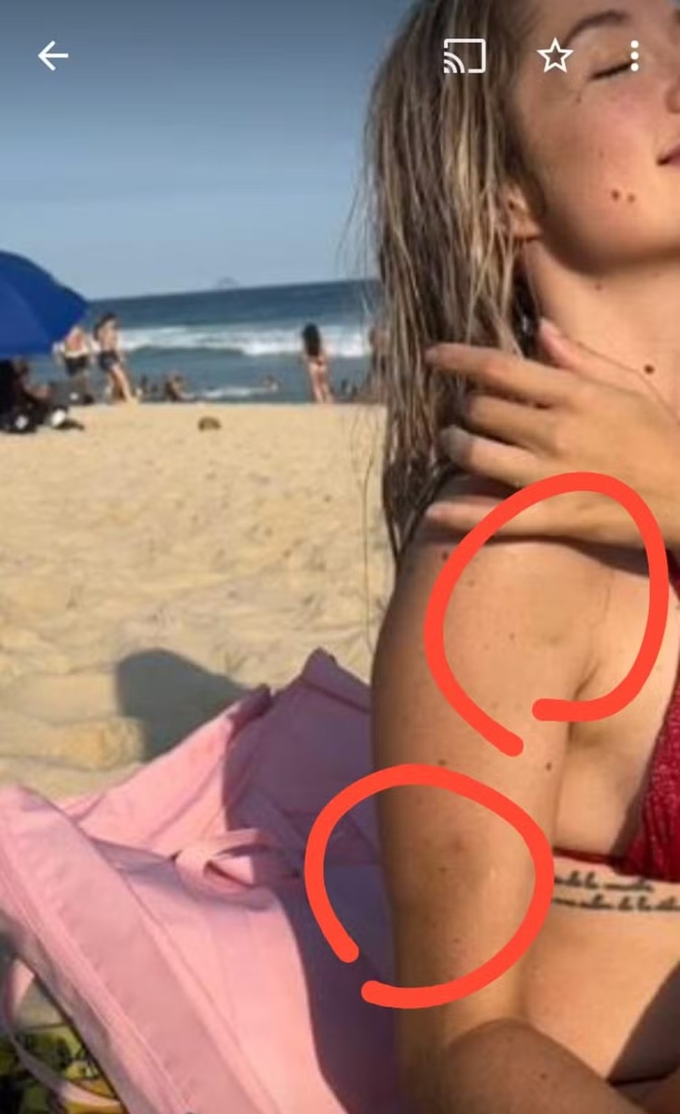 Larissa Natalya Ferrari mostra hematomas após suposta agressão — Foto: Reprodução