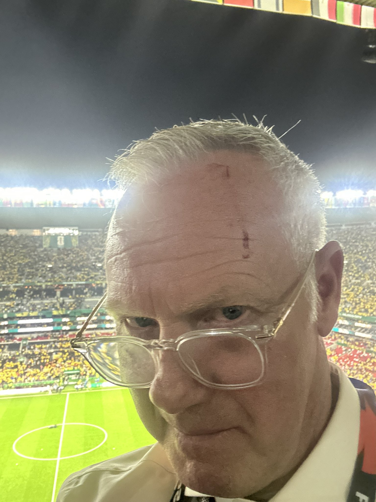 Comentarista leva garrafa na cabeça e sangra ao vivo durante Copa do Mundo