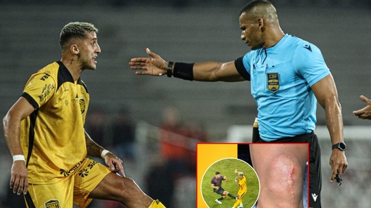 Em lance semelhante ao de Gustavo Gomez, árbitro dá amarelo para Alan Kardec e causa revolta - Foto: (João Normando/Amazonas FC)