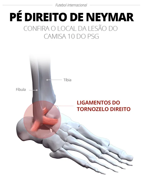 Lesionado, atacante Neymar desabafa após confirmação de cirurgia no joelho;  confira - Folha PE
