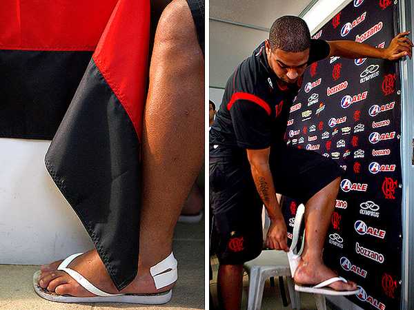 Adriano Revela Queimadura no Pé Antes de Final e Chuteira Vira Rifa