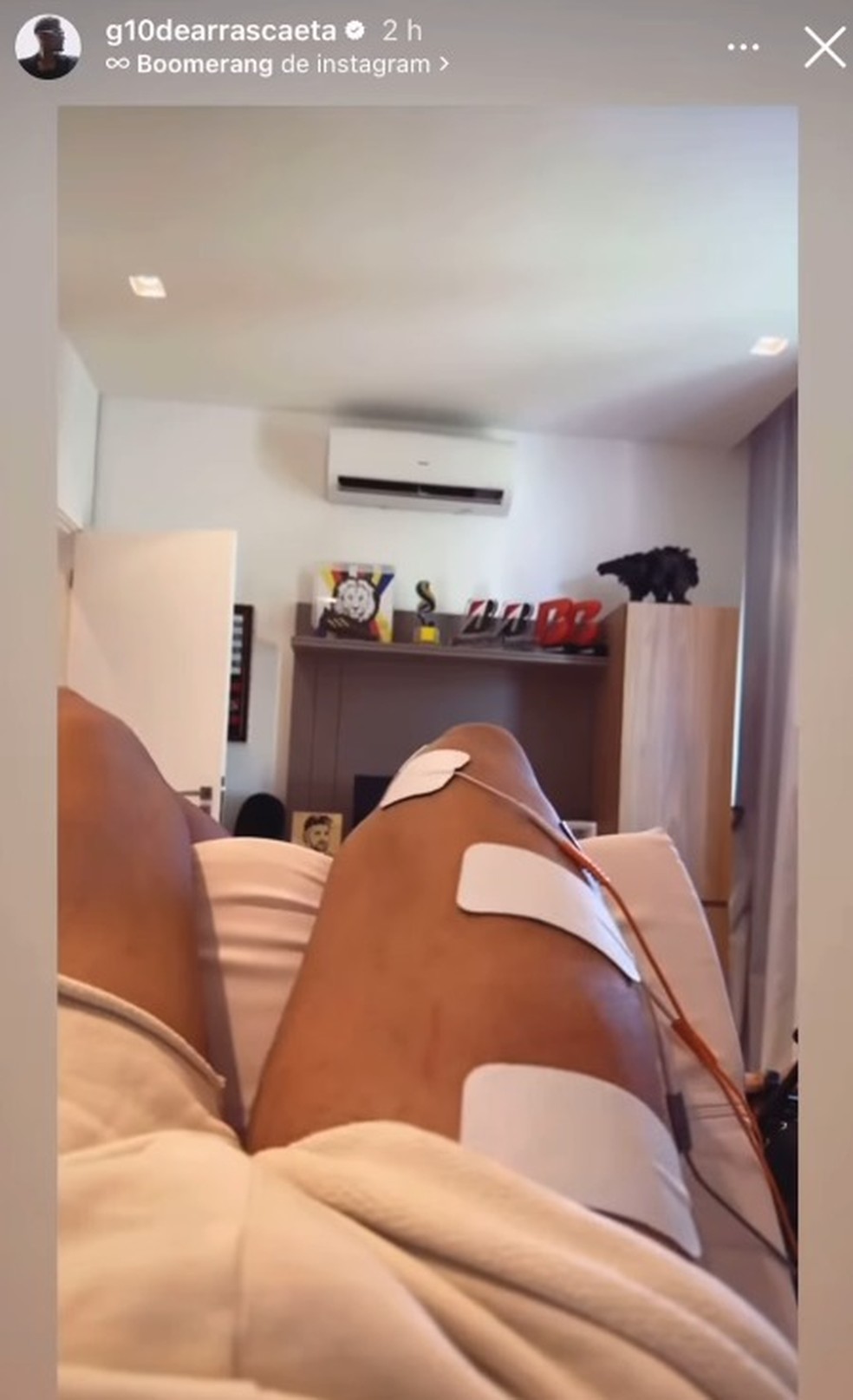 Arrascaeta, do FLamengo, posta tratamento em casa — Foto: Reprodução / Instagram