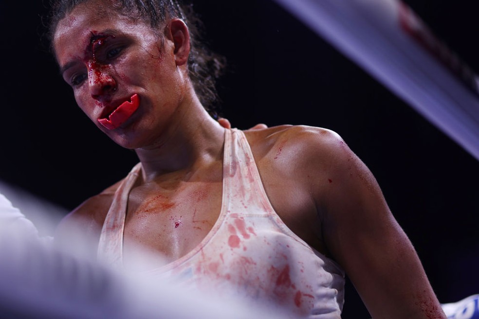 Argentina Yanina Lescano ficou com o rosto desfigurado em luta com Bia Ferreira — Foto: Mark Robinson/Matchroom Boxing via Getty Images