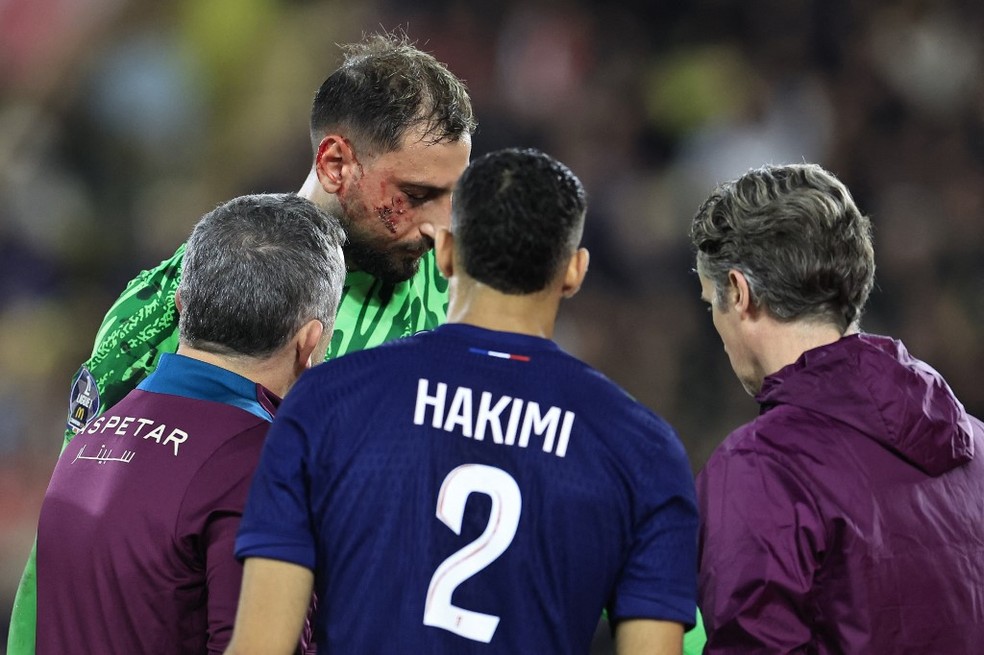 Singo acerta um pisão no rosto de Donnarumma durante o jogo entre Monaco e PSG — Foto: AFP