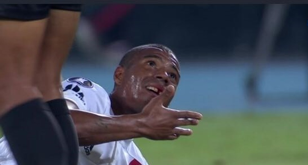 De La Cruz perdeu um dente em um Flamengo x River Plate em 2018 — Foto: Reprodução