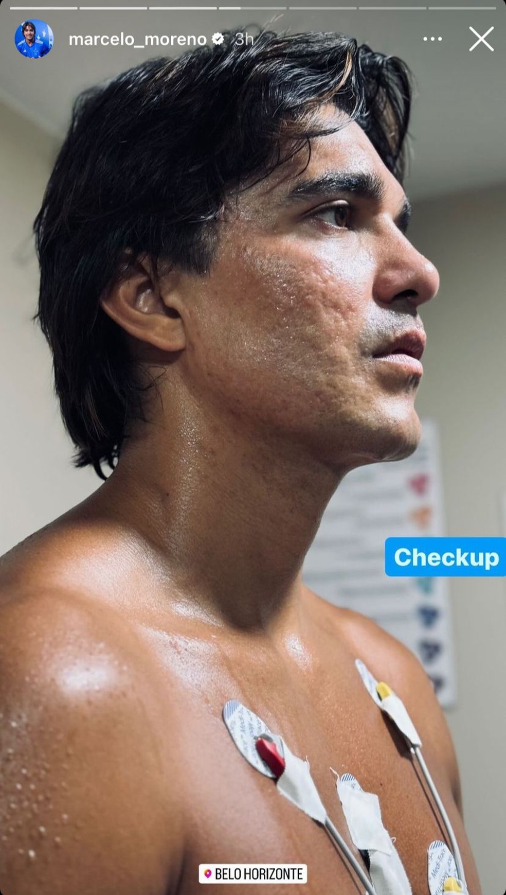 Marcelo Moreno passa por exames médicos no Cruzeiro — Foto: Redes sociais
