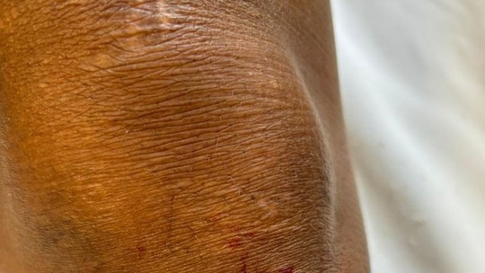 Imagens fortes! Jogadora do Santos sofre corte profundo no joelho; confira - Foto: (Reprodução)
