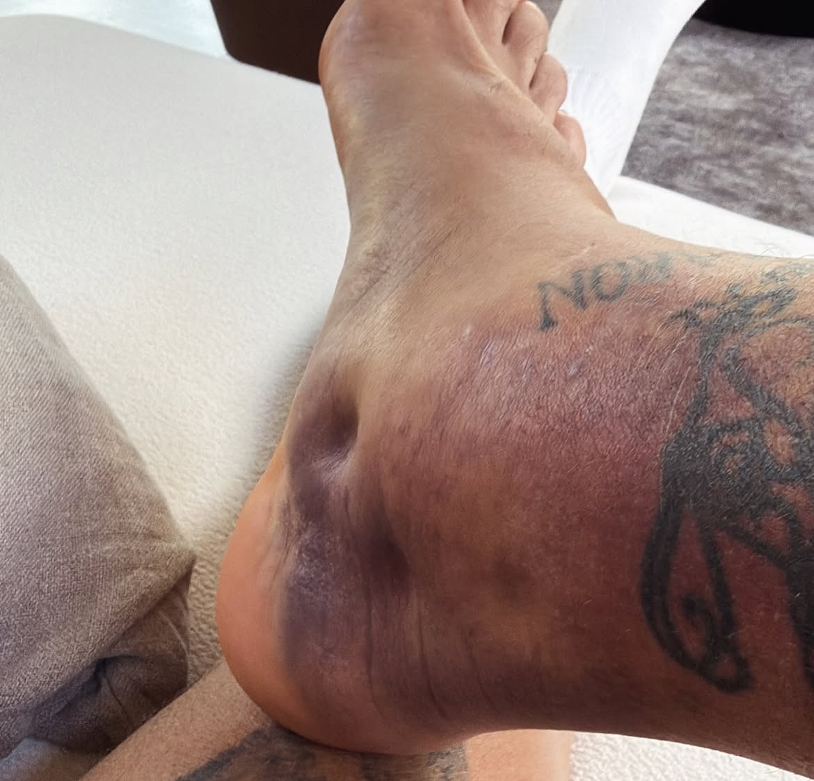 Zagueiro do Uruguai posta fotos de tornozelo inchado após fracasso da seleção na Copa do Mundo