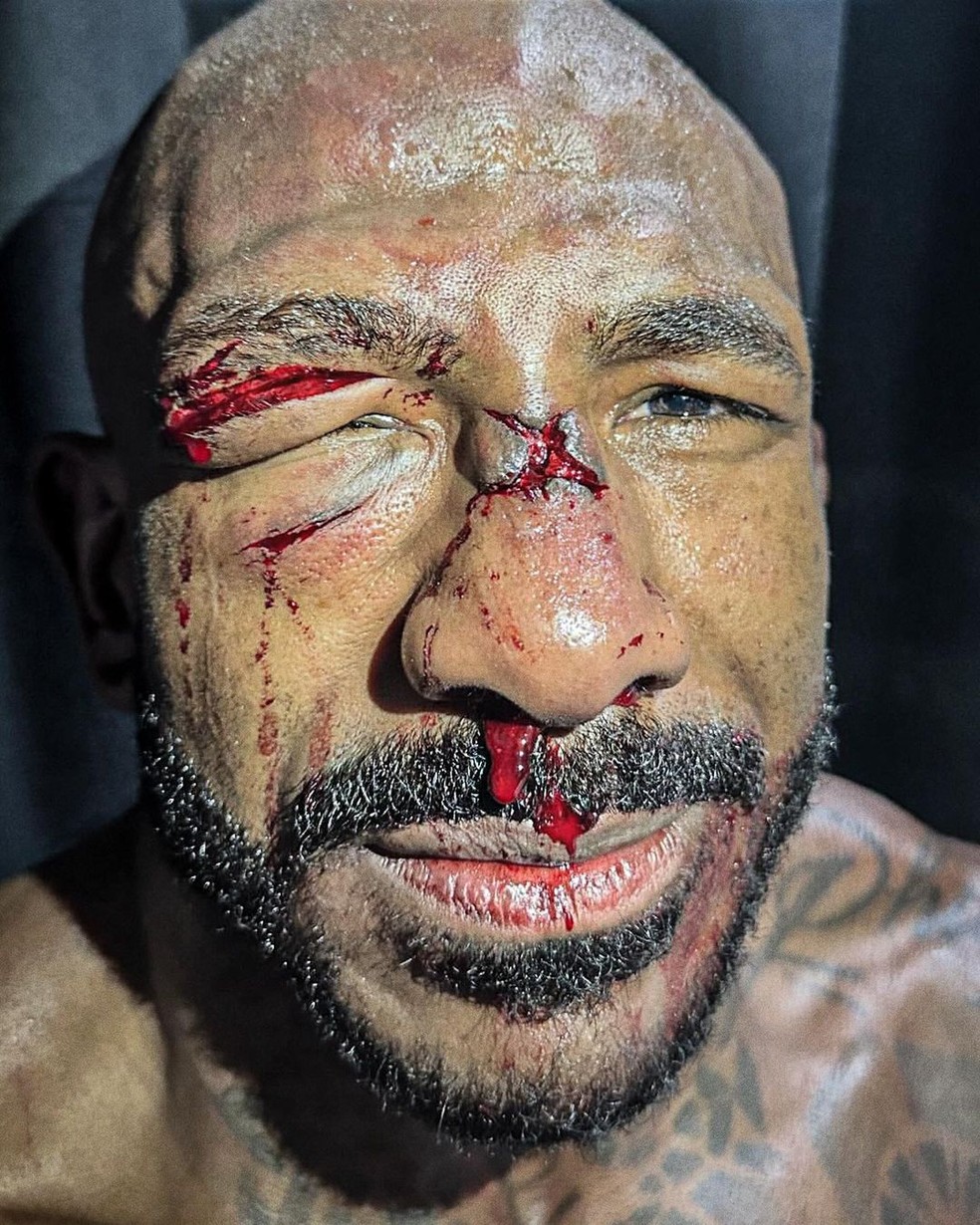 Khalil Rountree Jr. após luta com Poatan no UFC 307 — Foto: Reprodução/ Instagram