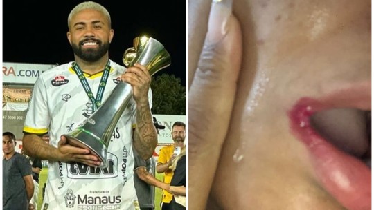 Acusado de agredir jovem em Belém no ano passado, atacante paraense volta ao Amazonas - Foto: (Reprodução)