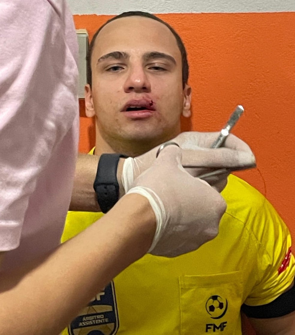 Árbitro assistente Gustavo Anibal Taques é agredido em Mato Grosso — Foto: Arquivo pessoal