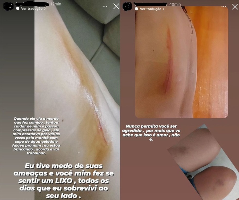 Imagens que a jovem publicou nas redes sociais — Foto: Reprodução / Redes Sociais
