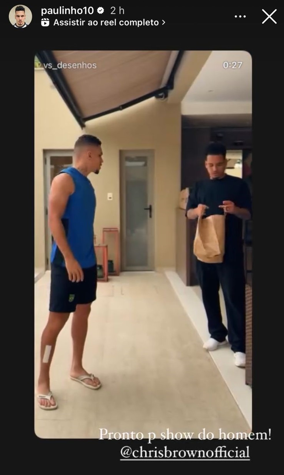 Paulinho com curativo na perna após cirurgia na canela — Foto: Reprodução