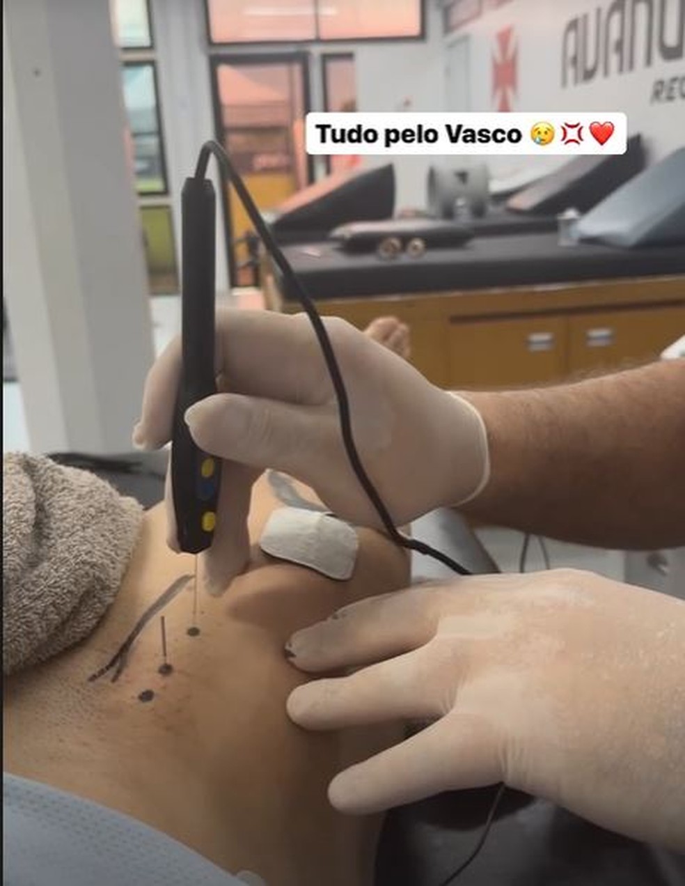 Medel, do Vasco, posta tratamento na virilha &mdash; Foto: Reprodu&ccedil;&atilde;o