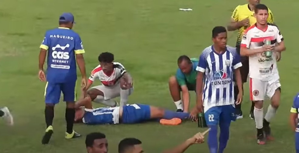 Um Jovem Jogador De Futebol Machucou Sua Perna Durante O Jogo E