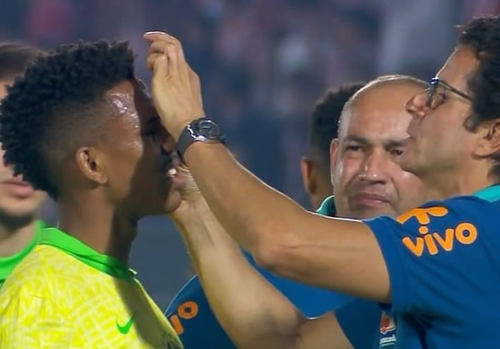 Estêvão se apresenta no Palmeiras sem queixas após pancada no rosto