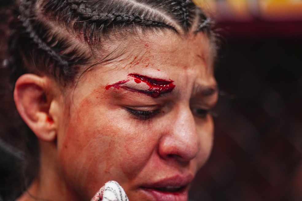 O corte profundo na testa de Mayra Sheetara no UFC 303 — Foto: Jeff Bottari/Zuffa LLC via Getty Images