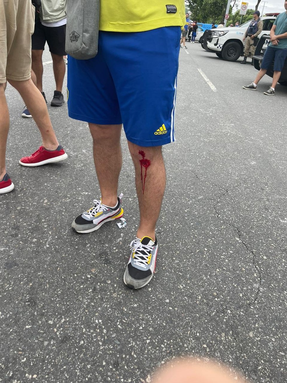 Torcedores se machucam em confronto com a polícia após tentativa de invasão — Foto: Caíque Andrade / ge