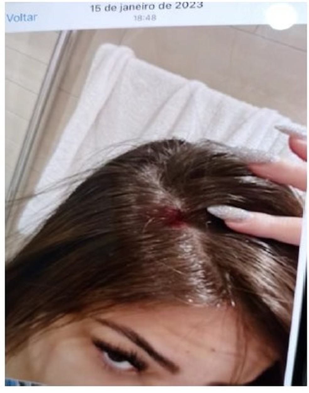 Gabriela Cavallin com ferimento na cabeça — Foto: Reprodução