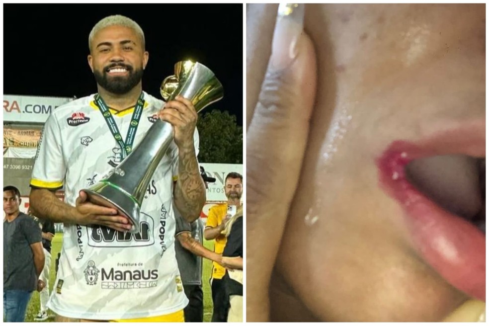 Douglas Santos, conhecido como DG, é acusado de agredir uma jovem em Belém — Foto: Reprodução
