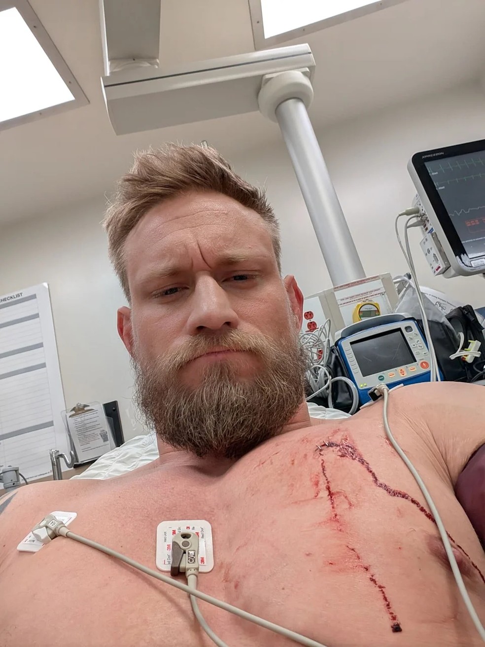 Mariusz Ksiazkiewicz exibe ferimento no hospital &mdash; Foto: Reprodu&ccedil;&atilde;o