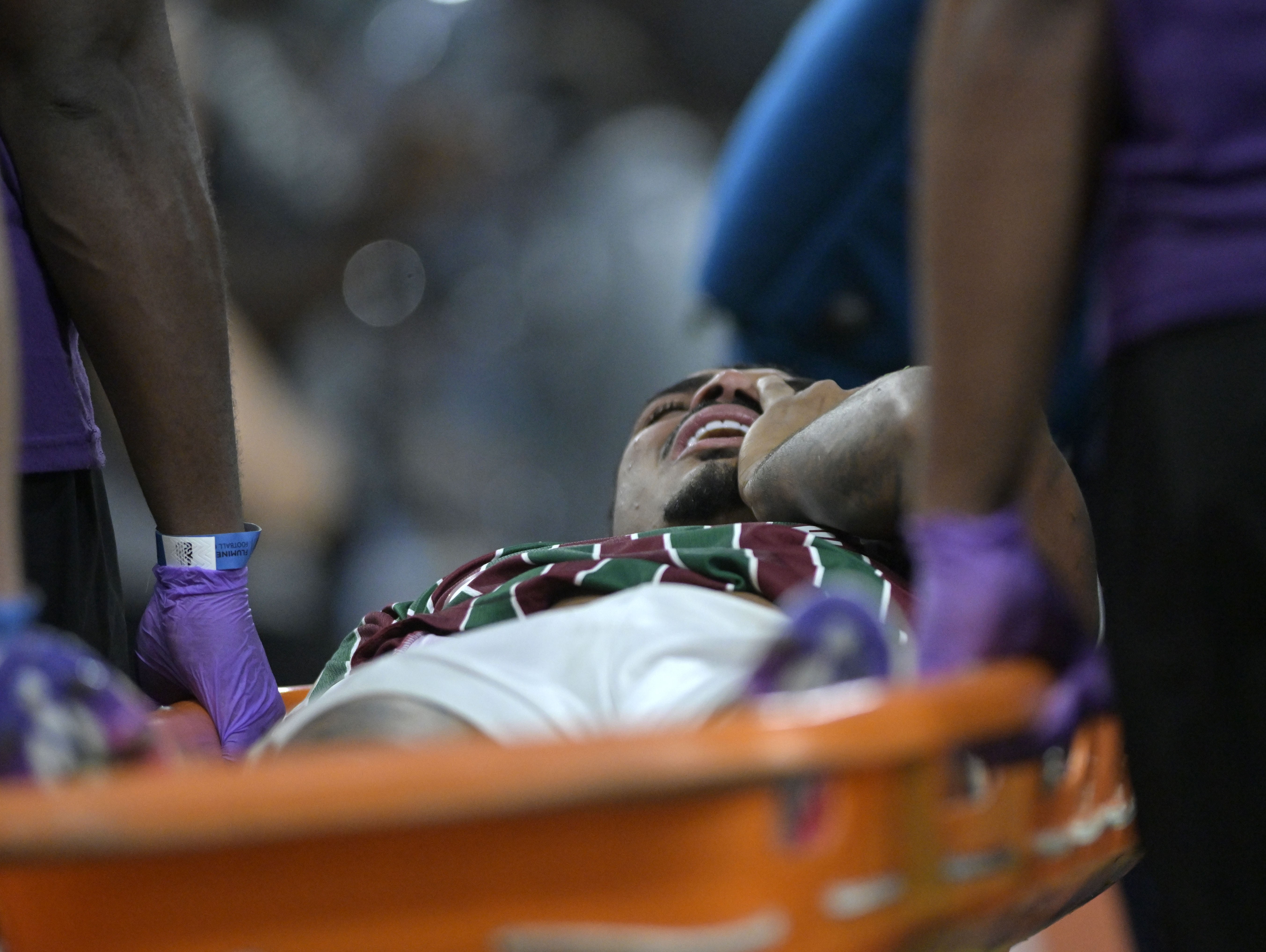 John Kennedy, atacante do Fluminense, passa por cirurgia no joelho e deve ficar fora por até oito meses
