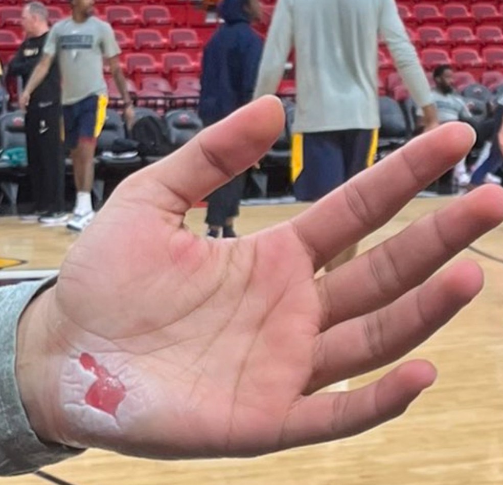 IMAGEM FORTE: Jamal Murray queima mão no Jogo 3 das Finais da NBA, nba
