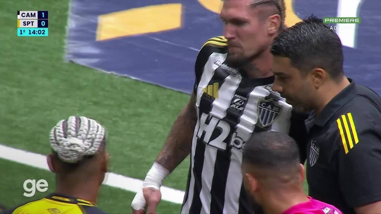 Lyanco passa por cirurgia e desfalca Atlético-MG na temporada