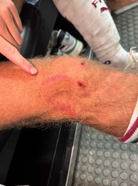 Irritação com arbitragem toma conta do vestiário do Fluminense após clássico; veja detalhes